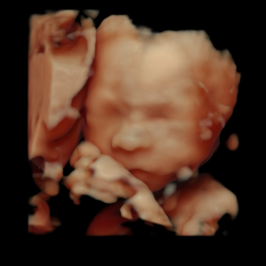 Photo shared by Baylie for their Babylist baby registry.