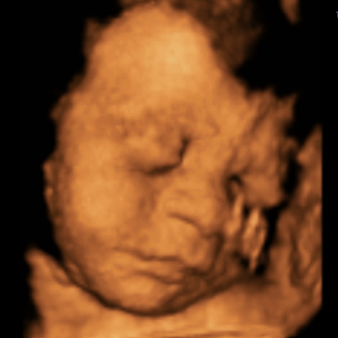 Photo shared by Abigail for their Babylist baby registry.