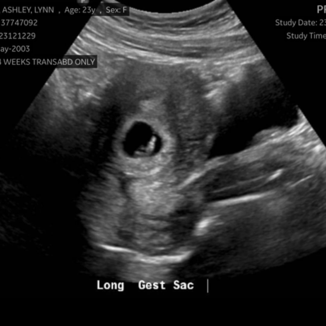 Photo shared by Ashley for their Babylist baby registry.