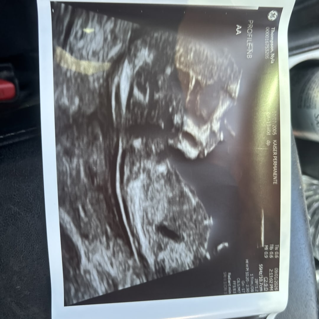 Photo shared by Nyla for their Babylist baby registry.