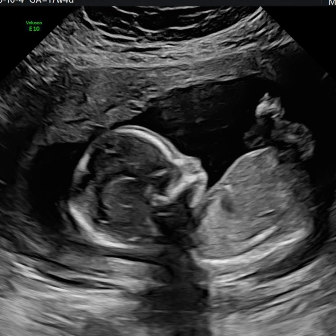 Photo shared by Mariah & Tyler for their Babylist baby registry.