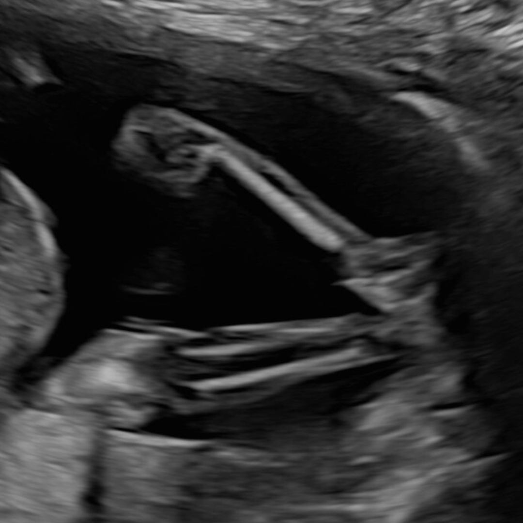 Photo shared by Kat for their Babylist baby registry.