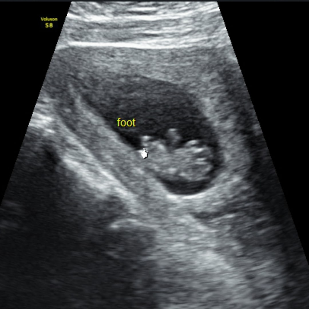 Photo shared by Brianna for their Babylist baby registry.