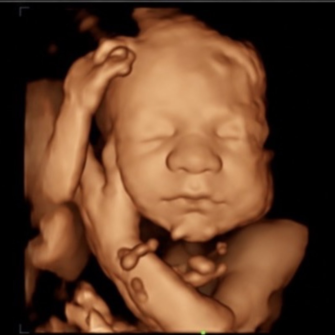 Photo shared by Brookley (Brooke) for their Babylist baby registry.