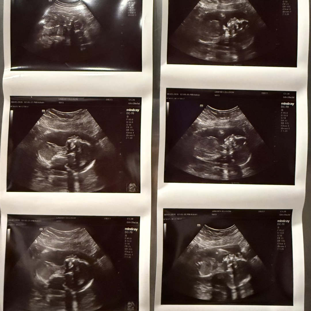 Photo shared by Ellie for their Babylist baby registry.