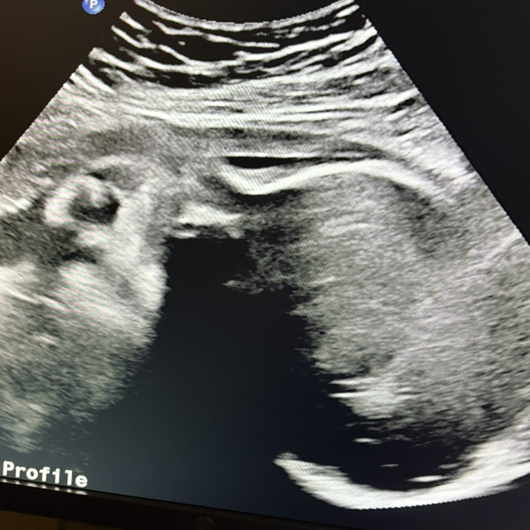 Photo shared by Michelle for their Babylist baby registry.