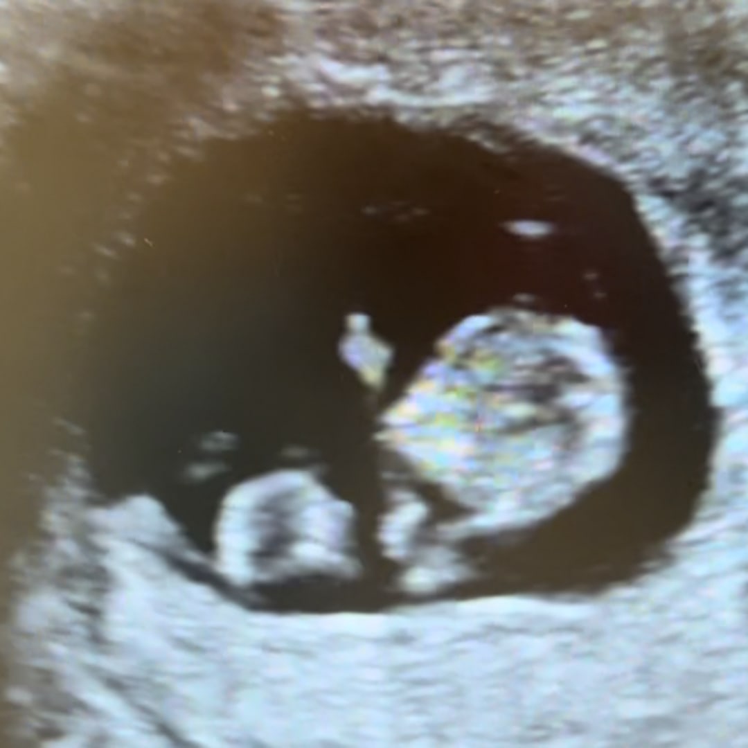 Photo shared by Gianna for their Babylist baby registry.