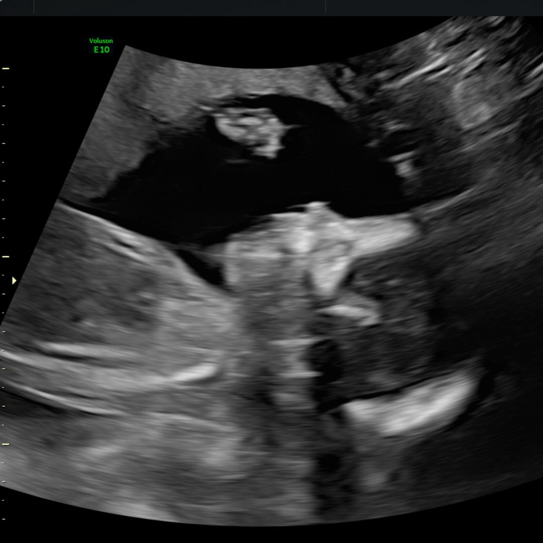 Photo shared by Madison for their Babylist baby registry.