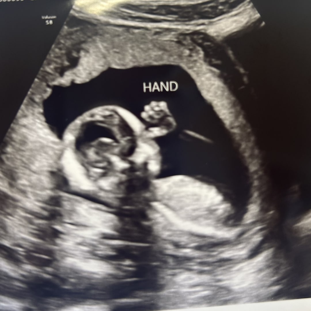 Photo shared by Destiny for their Babylist baby registry.