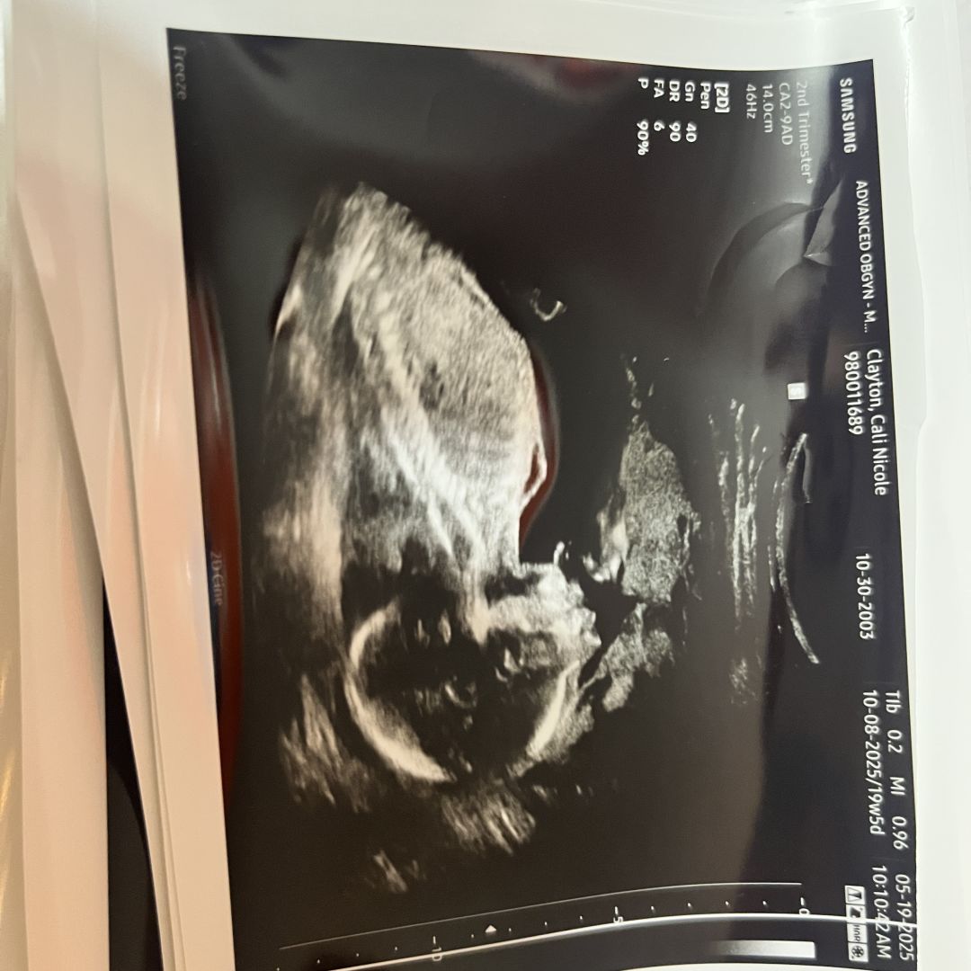 Photo shared by Cali for their Babylist baby registry.