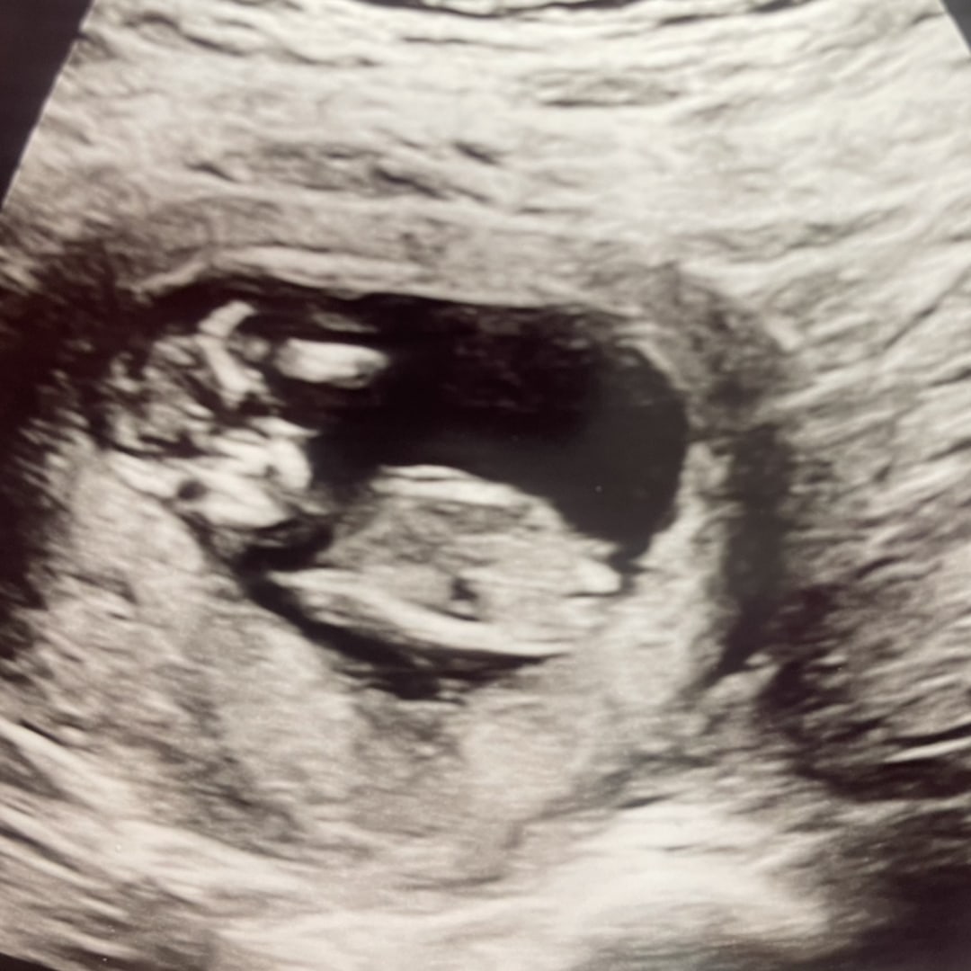 Photo shared by Haleigh for their Babylist baby registry.