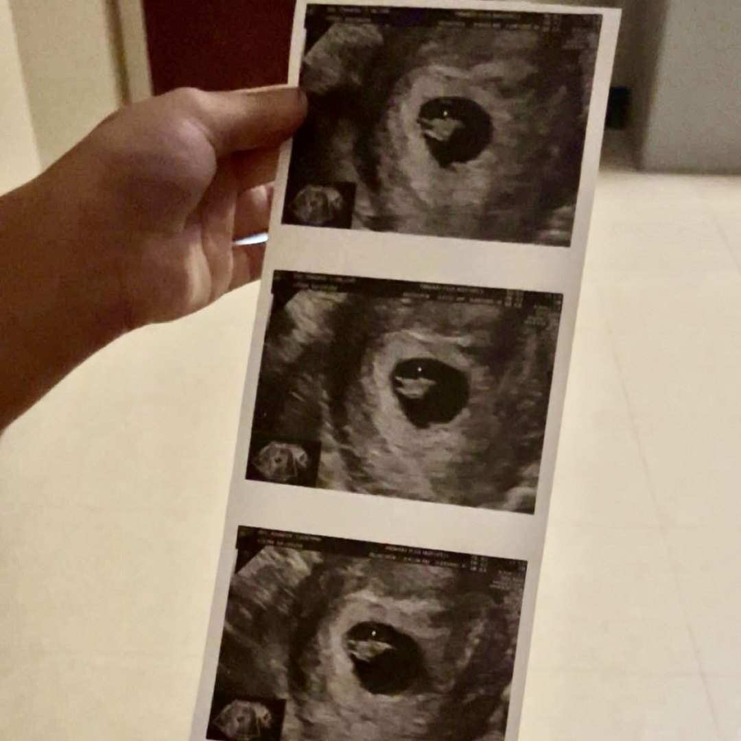 Photo shared by Jennifer for their Babylist baby registry.
