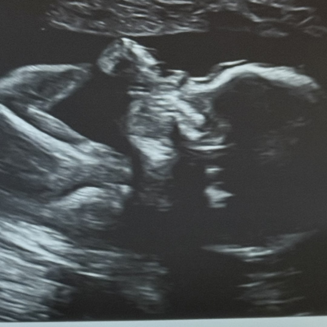 Photo shared by Zamiyah for their Babylist baby registry.