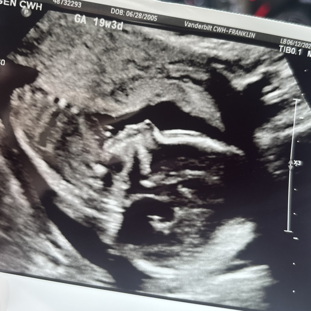Photo shared by Samantha for their Babylist baby registry.