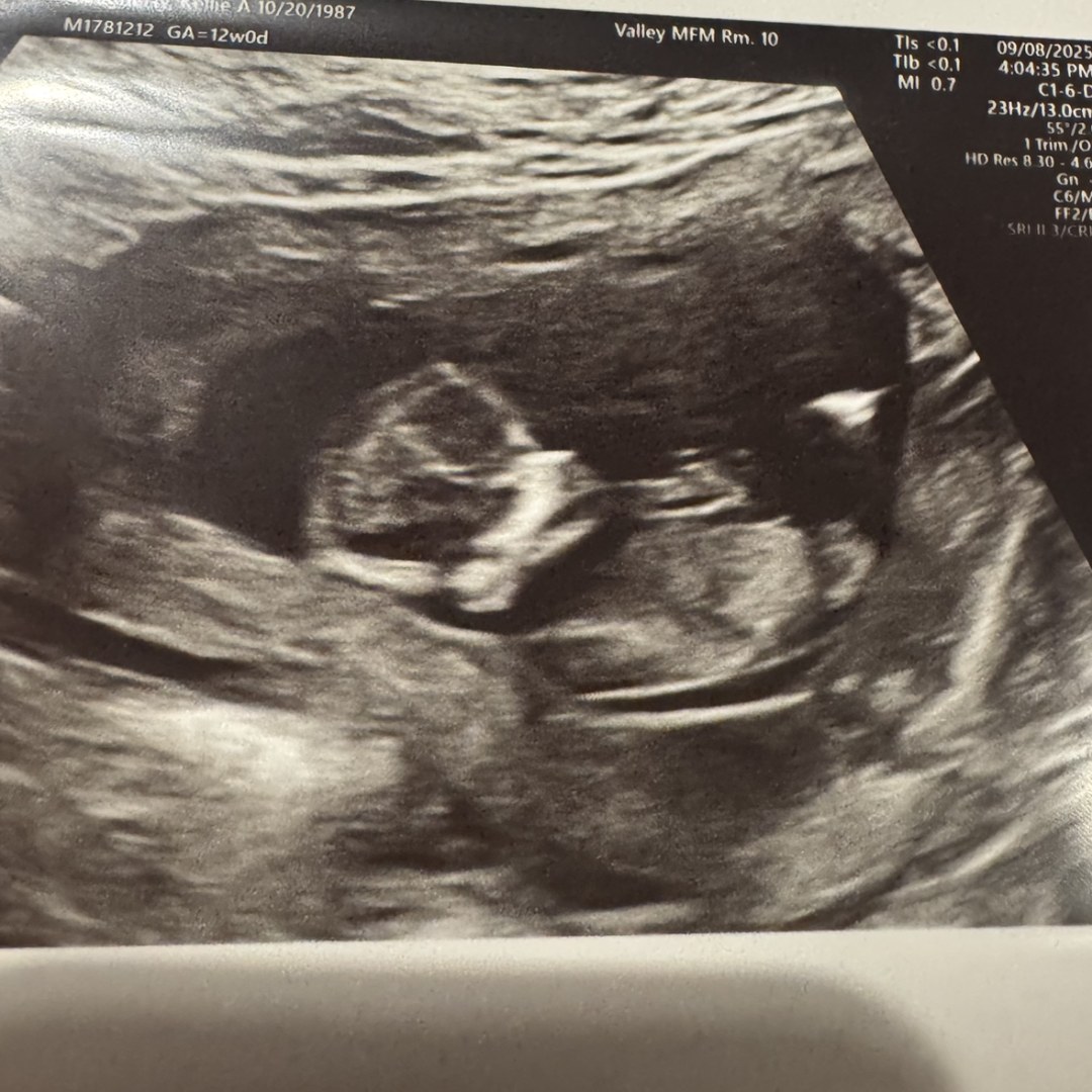 Photo shared by Kellie for their Babylist baby registry.