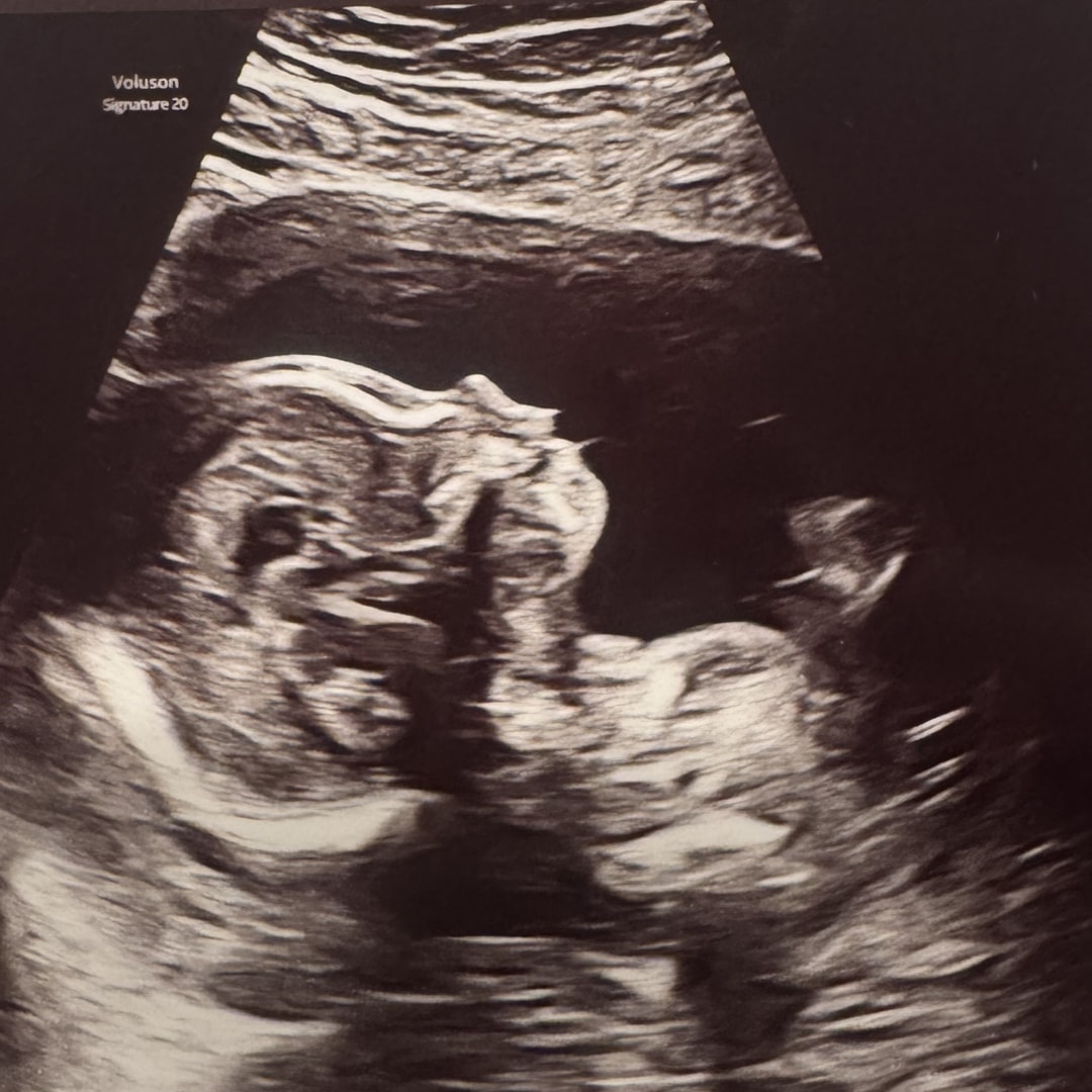 Photo shared by Cait for their Babylist baby registry.