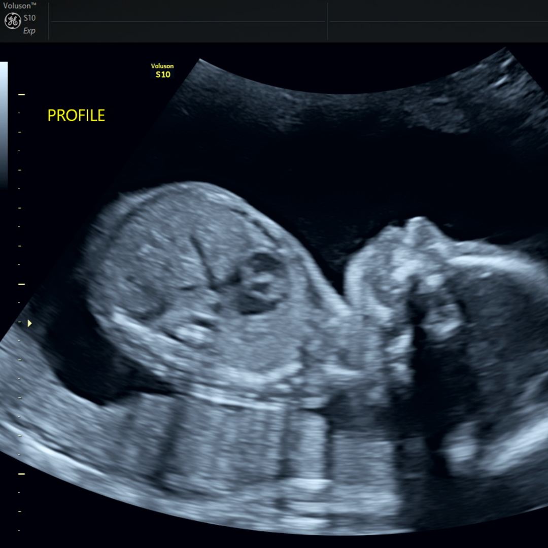 Photo shared by Danielle for their Babylist baby registry.