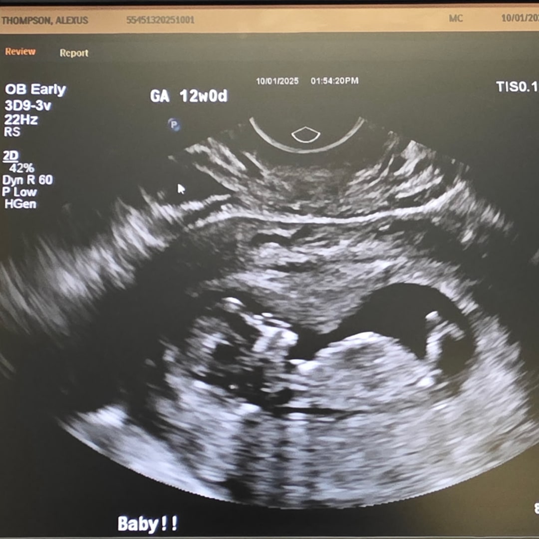 Photo shared by Alexus for their Babylist baby registry.