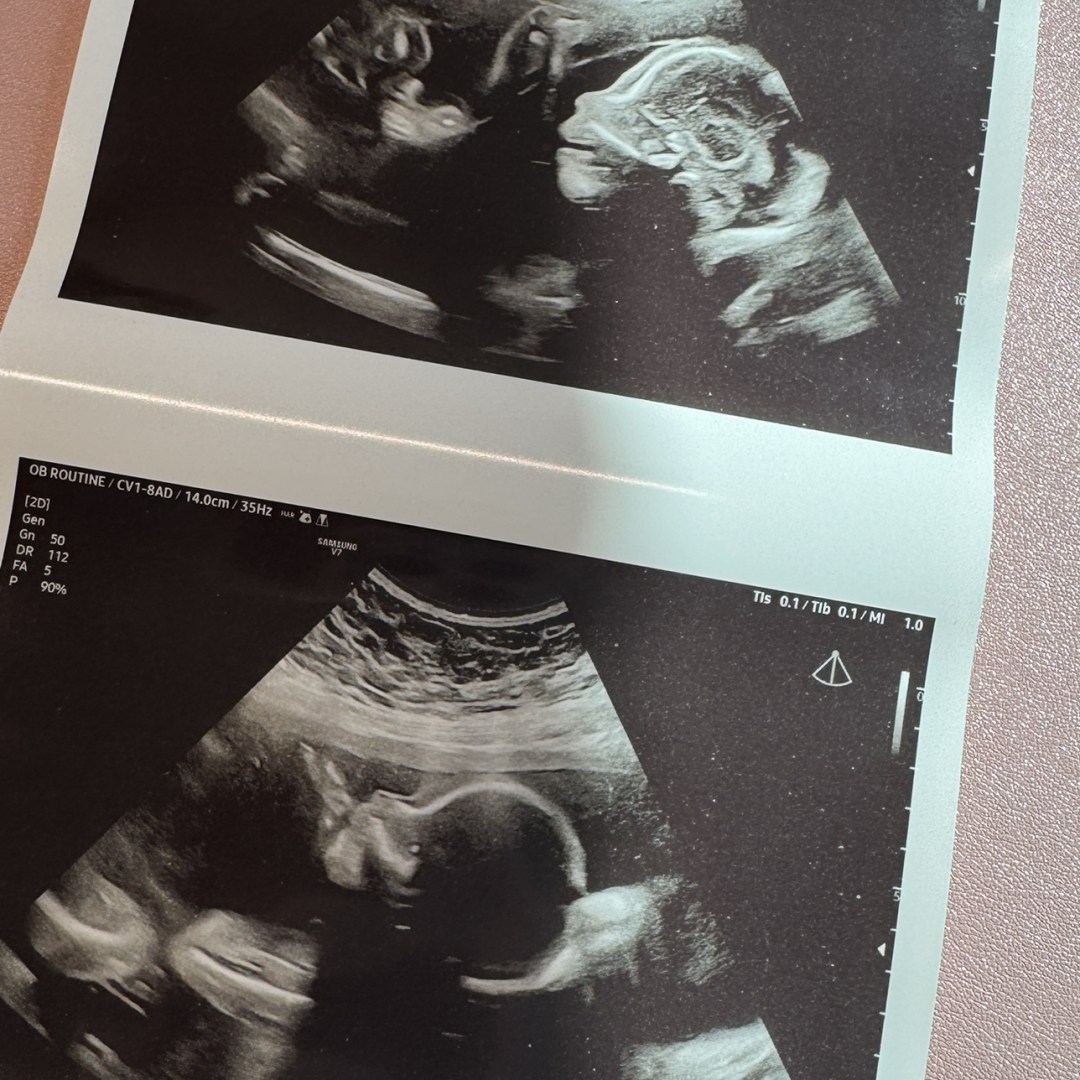 Photo shared by Taylor for their Babylist baby registry.