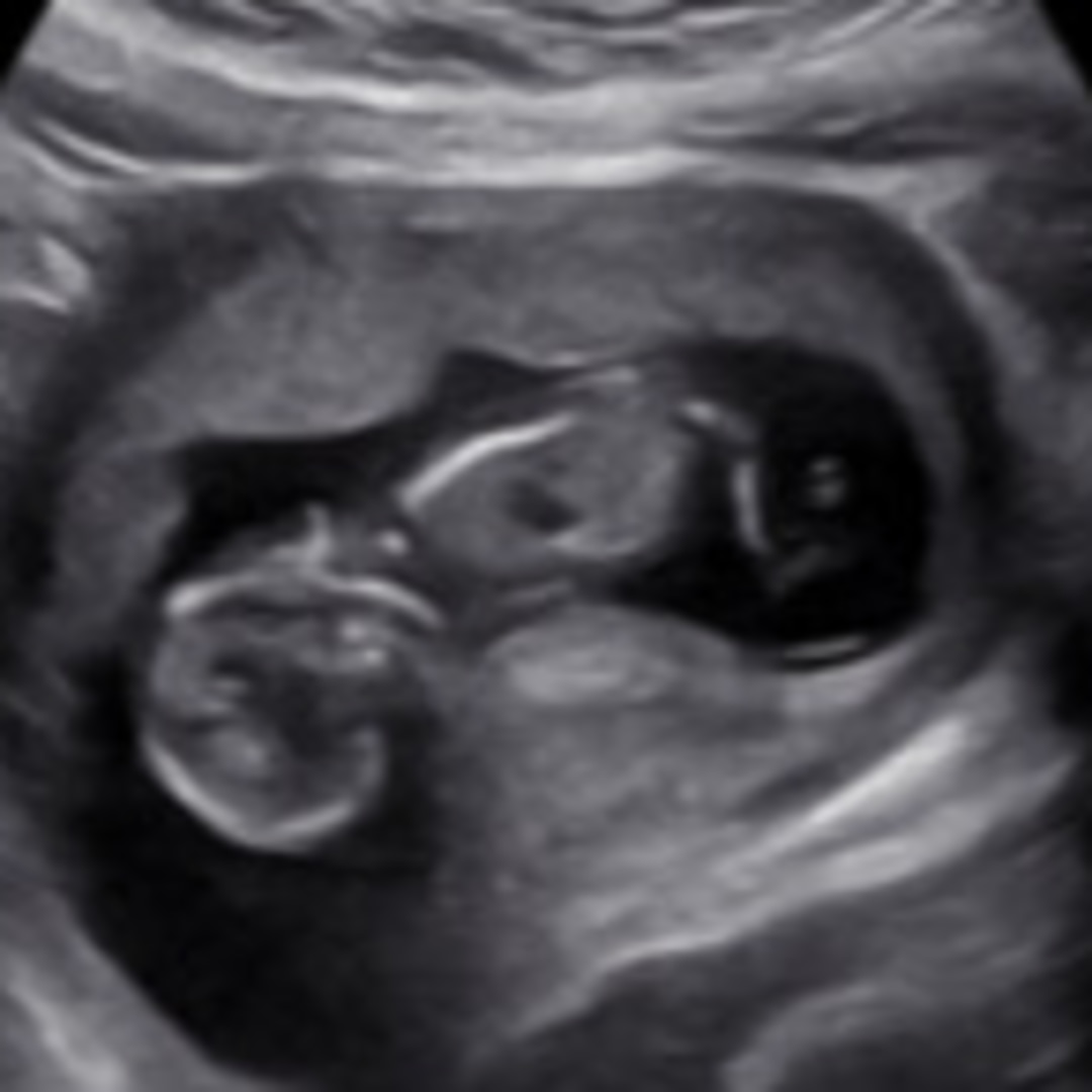 Photo shared by Alexis for their Babylist baby registry.