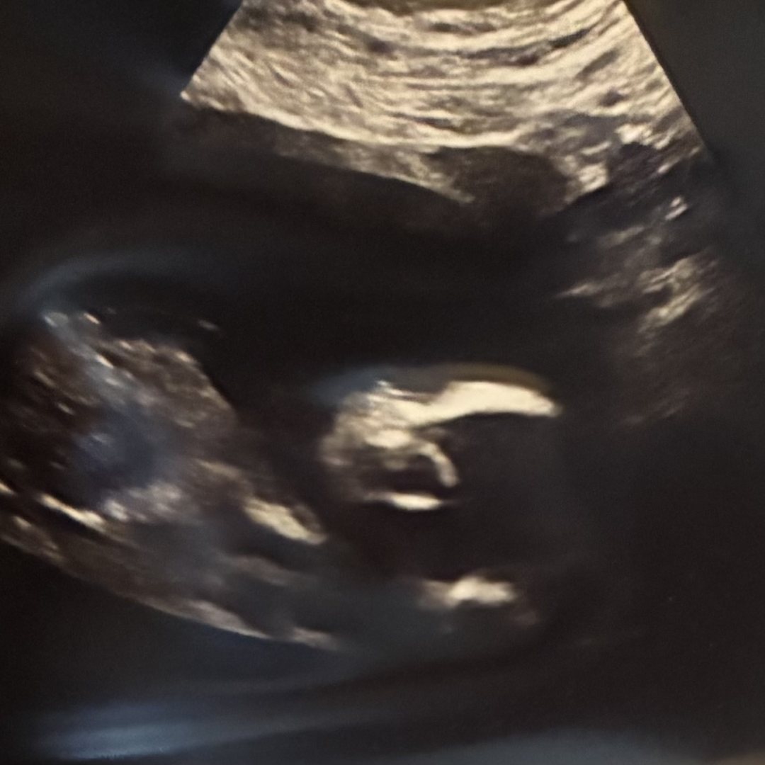 Photo shared by Kylie for their Babylist baby registry.