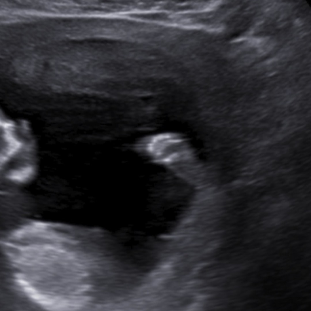 Photo shared by Hailey for their Babylist baby registry.