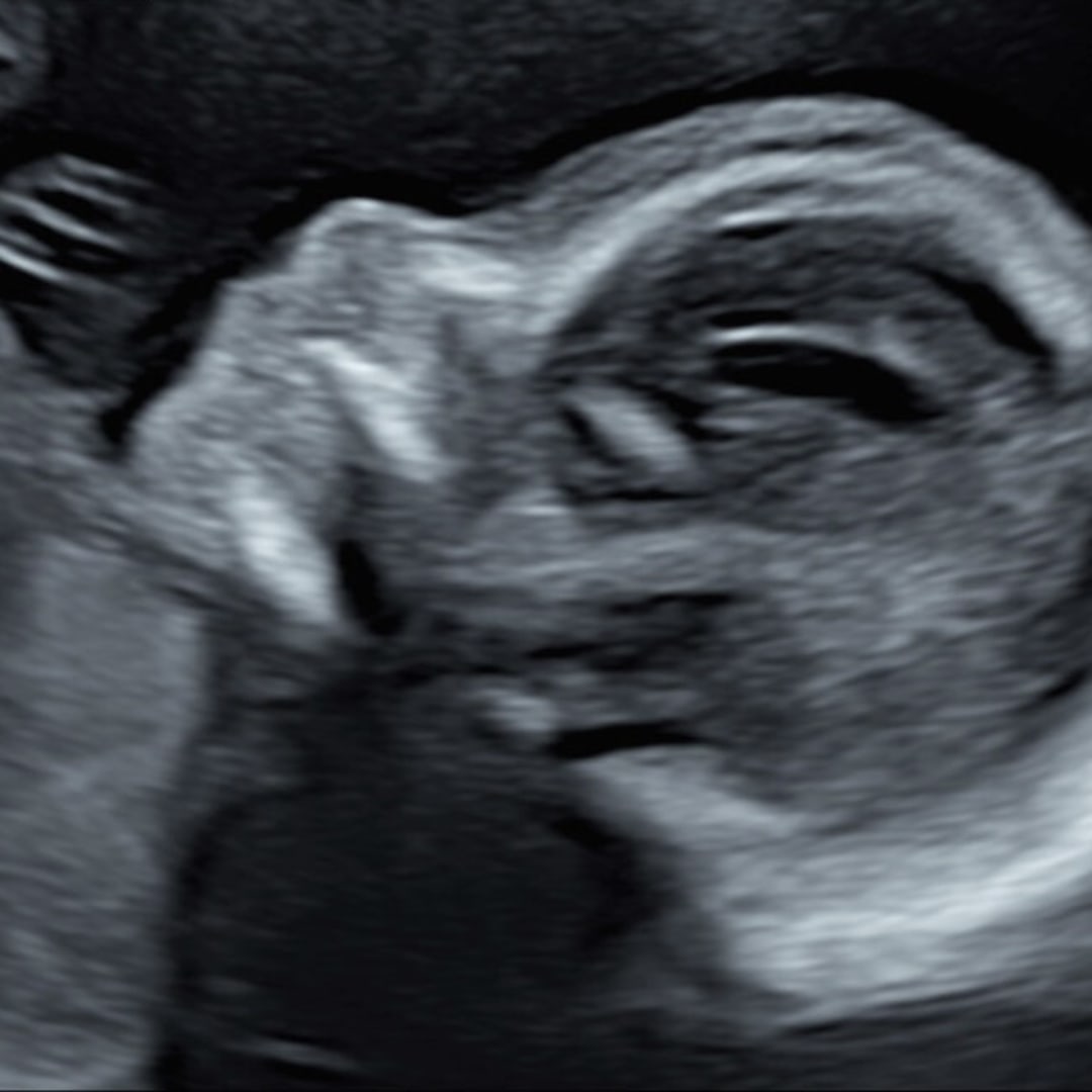 Photo shared by DESTINY for their Babylist baby registry.