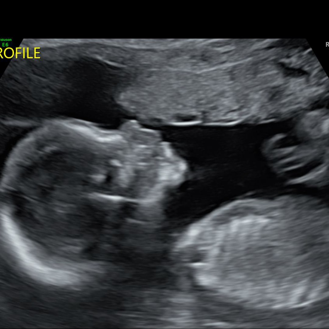 Photo shared by Emily for their Babylist baby registry.