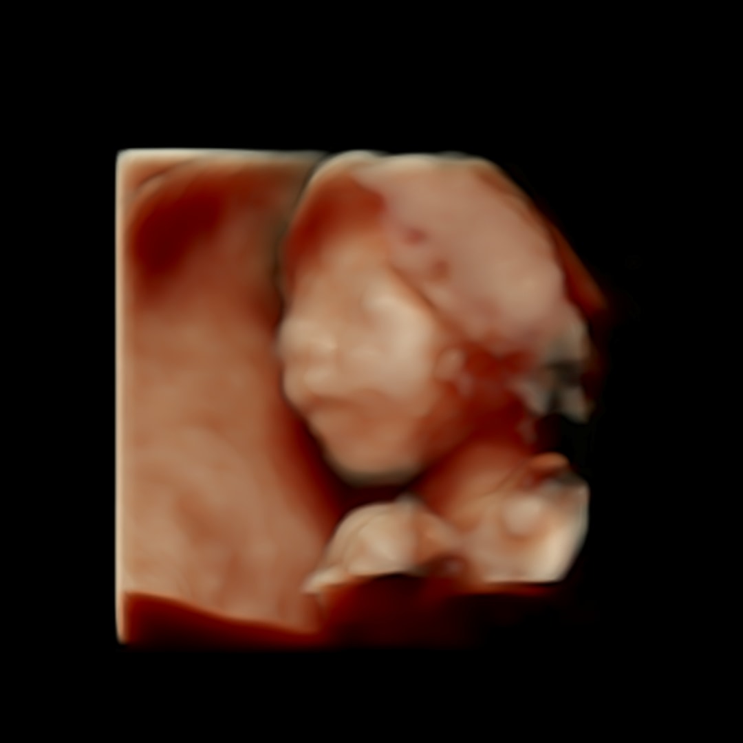 Photo shared by Ashley for their Babylist baby registry.