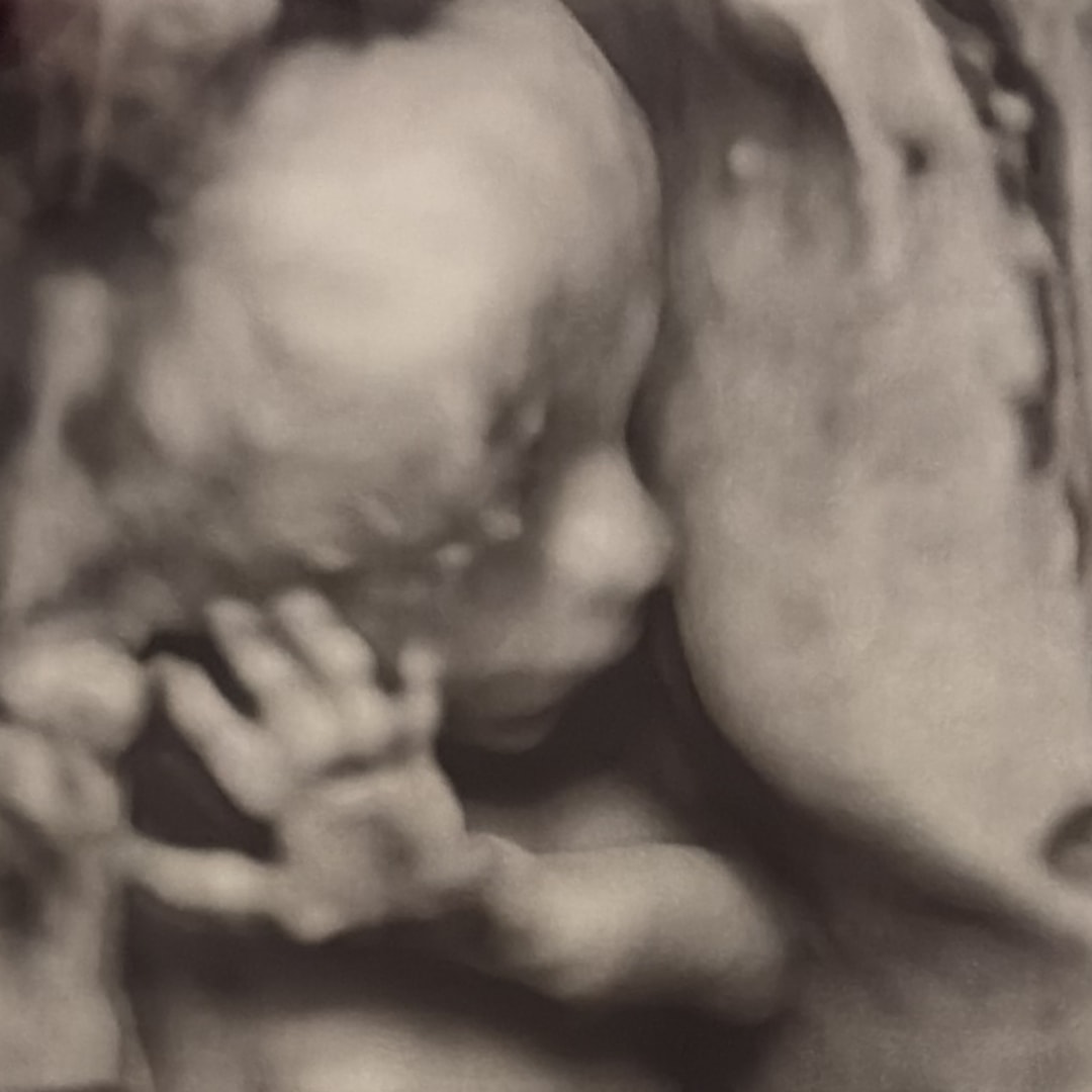 Photo shared by Hunter for their Babylist baby registry.