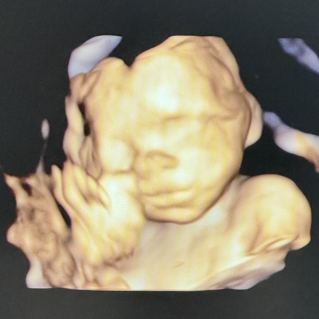 Photo shared by Leslie for their Babylist baby registry.
