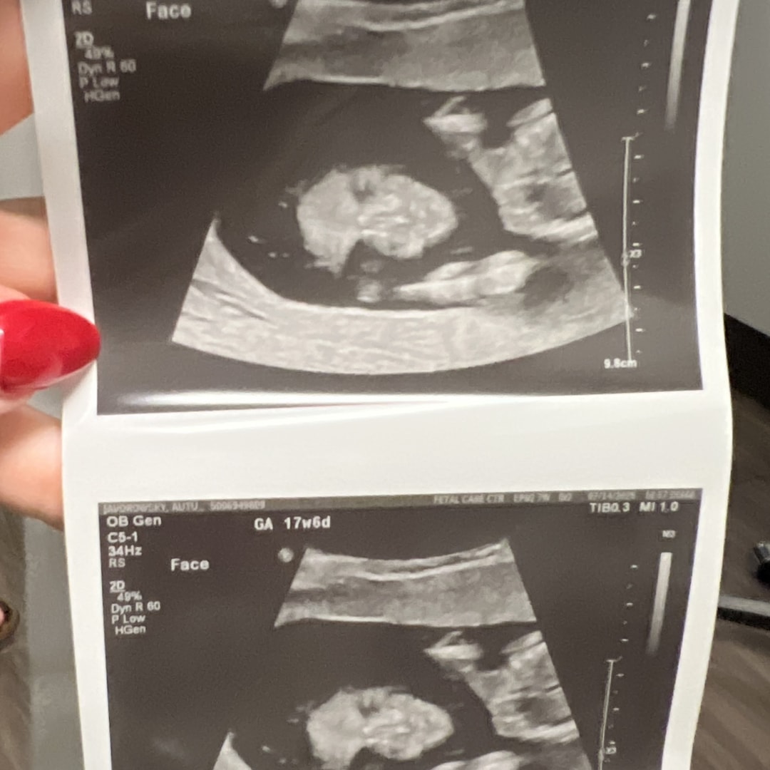 Photo shared by Autumn for their Babylist baby registry.