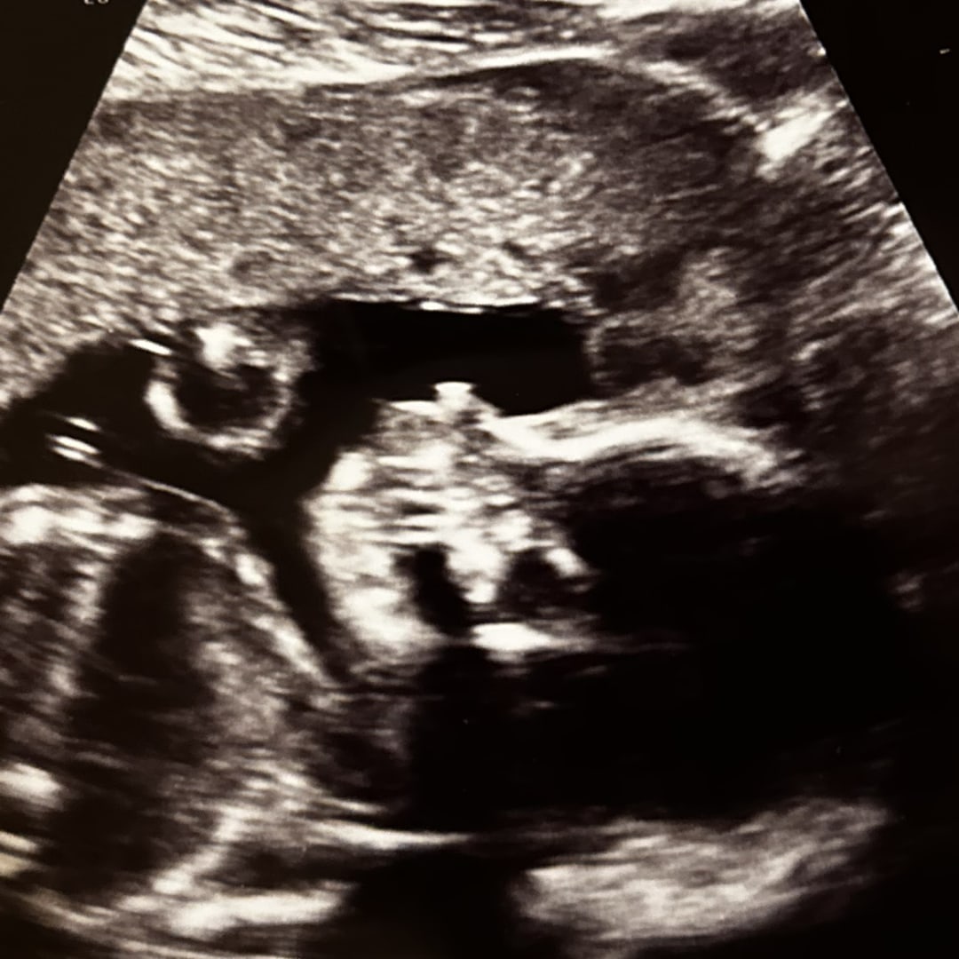 Photo shared by Emma for their Babylist baby registry.