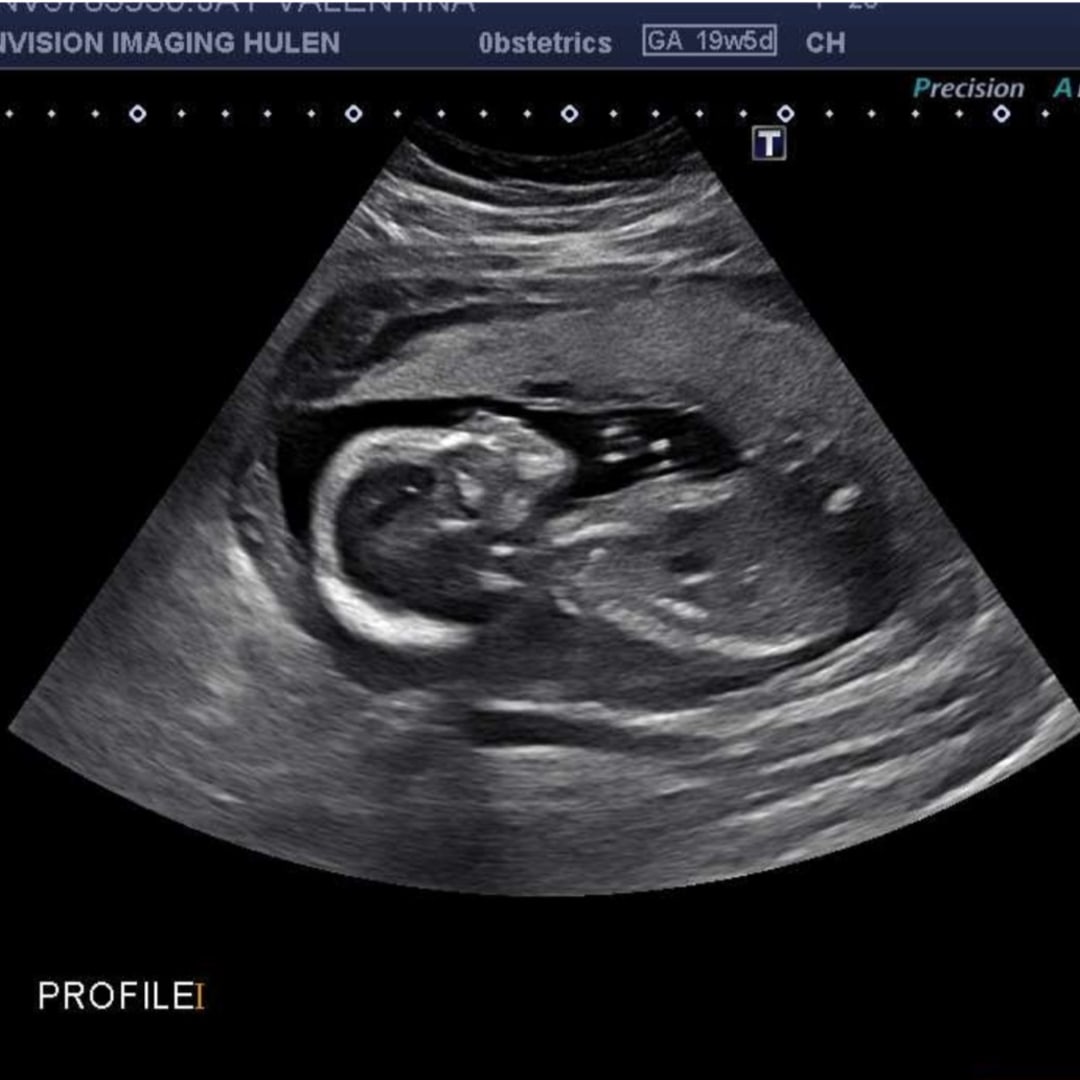 Photo shared by Valentina for their Babylist baby registry.