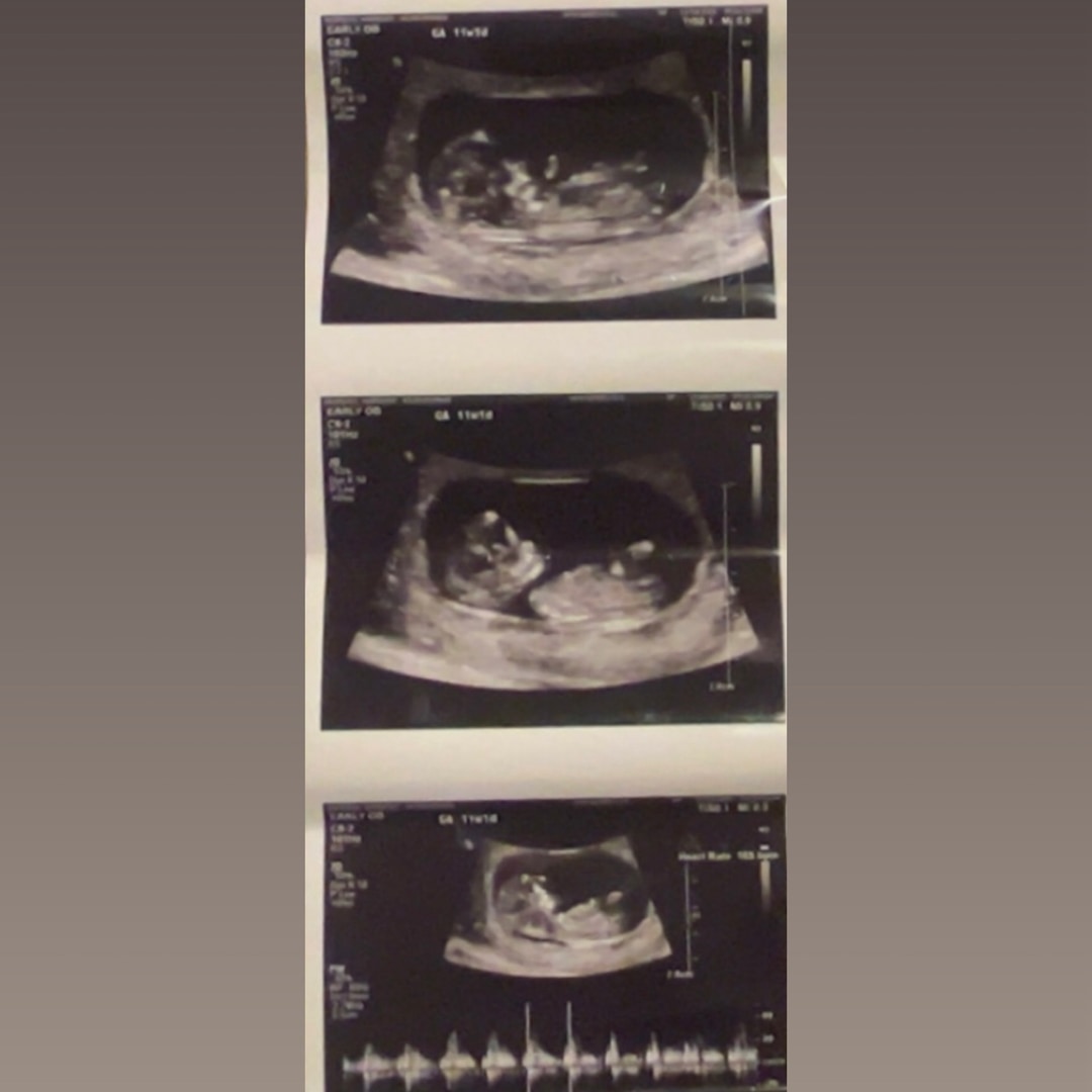 Photo shared by Harmony for their Babylist baby registry.