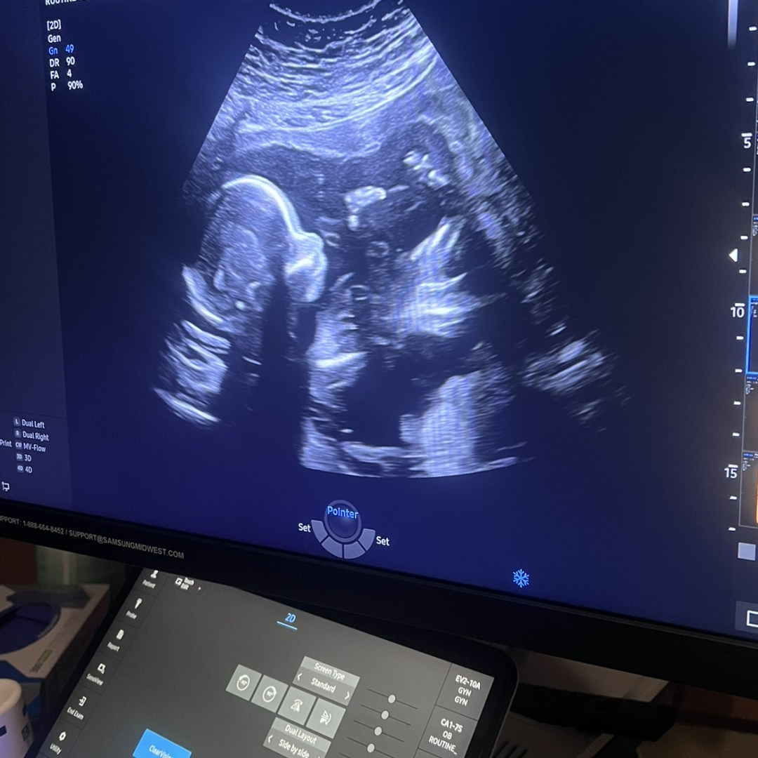 Photo shared by Emily for their Babylist baby registry.