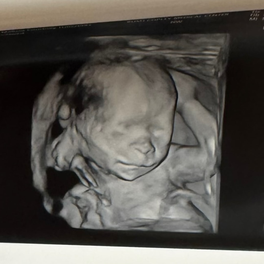 Photo shared by Melissa for their Babylist baby registry.