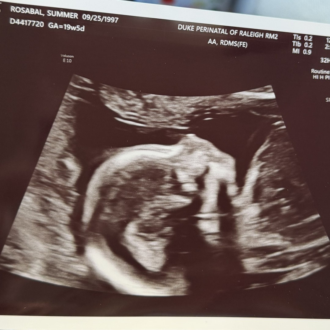 Photo shared by Summer for their Babylist baby registry.