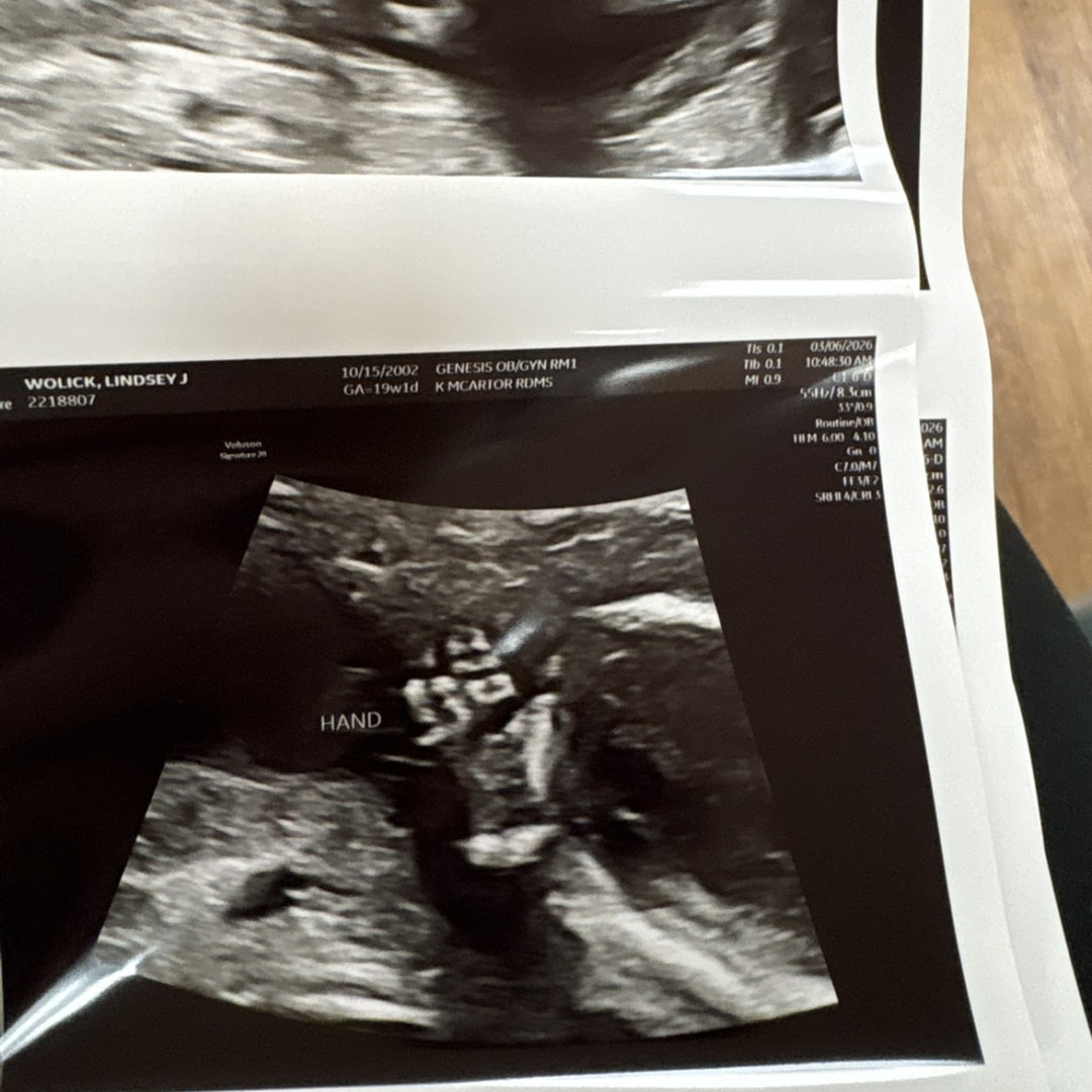 Photo shared by Lindsey for their Babylist baby registry.