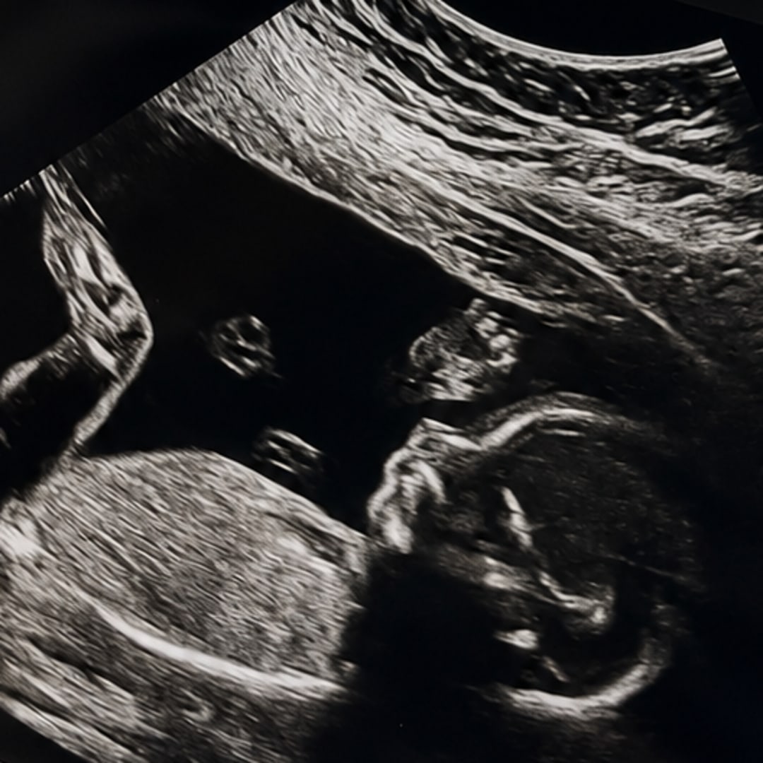 Photo shared by Valeria for their Babylist baby registry.