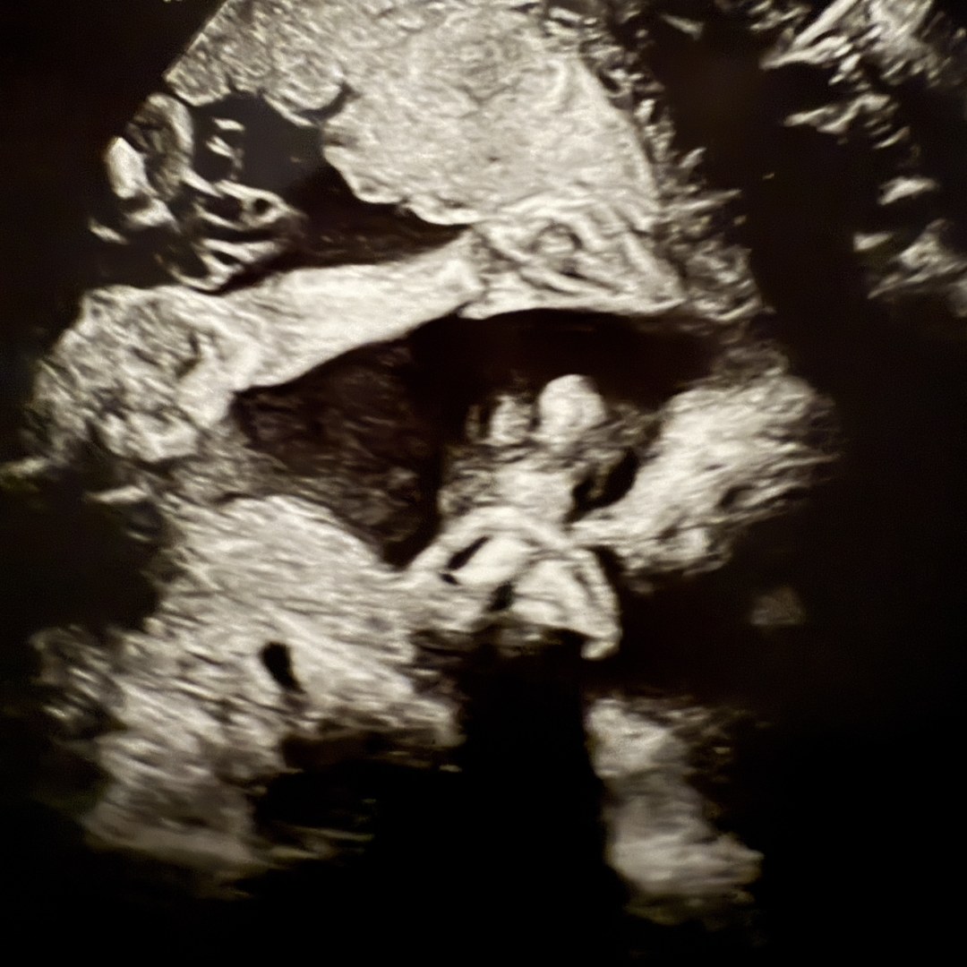 Photo shared by Crissy for their Babylist baby registry.