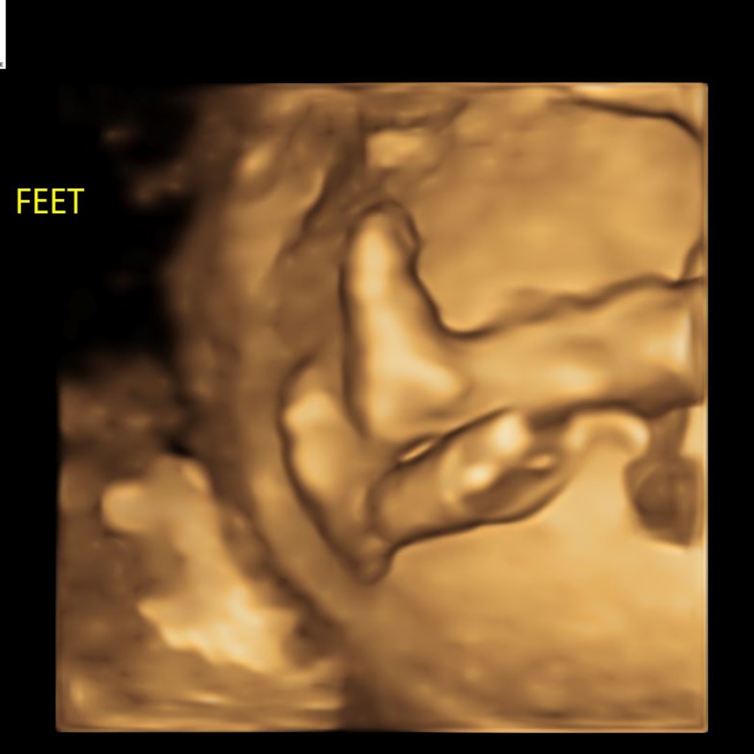 Photo shared by Ashley for their Babylist baby registry.