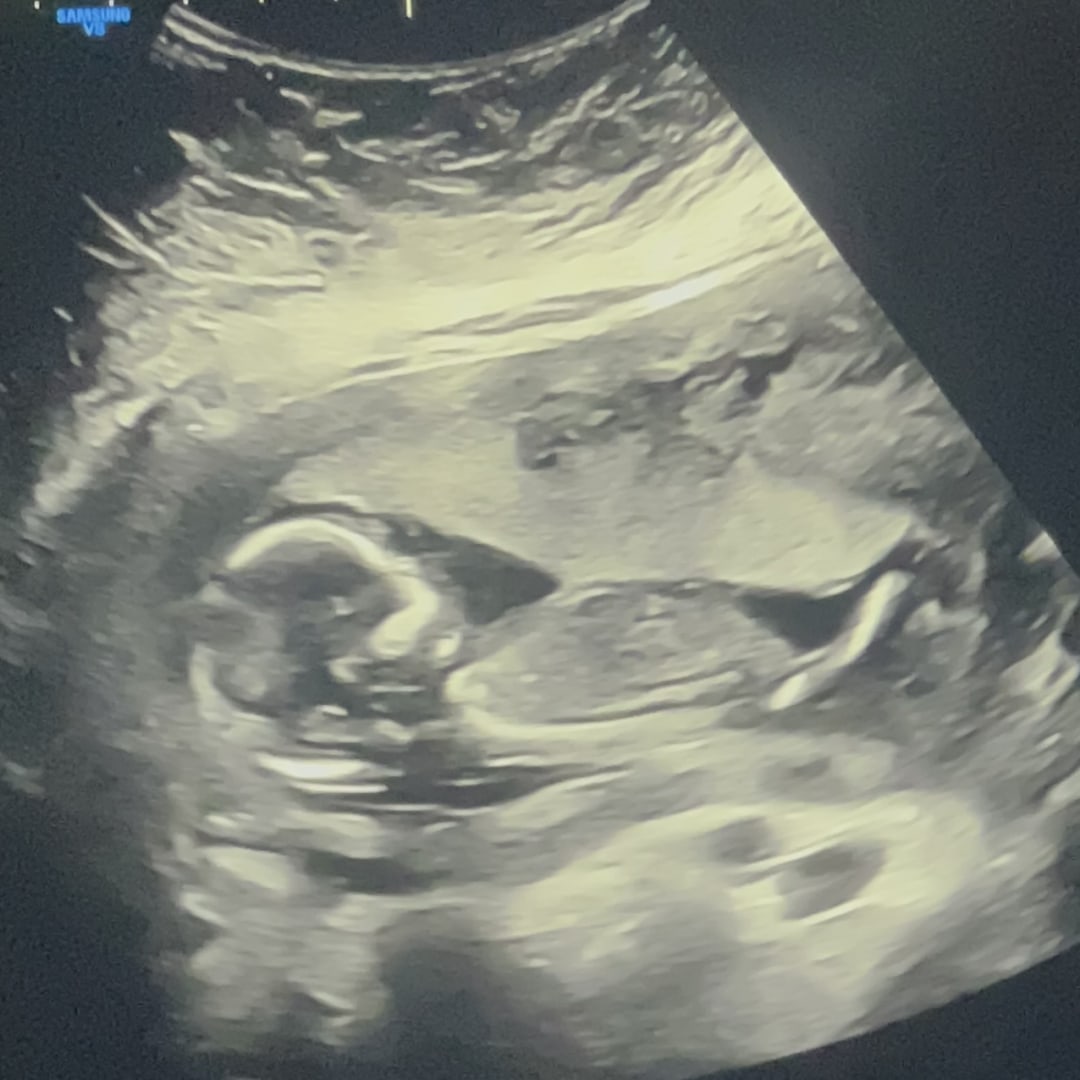 Photo shared by Karla for their Babylist baby registry.