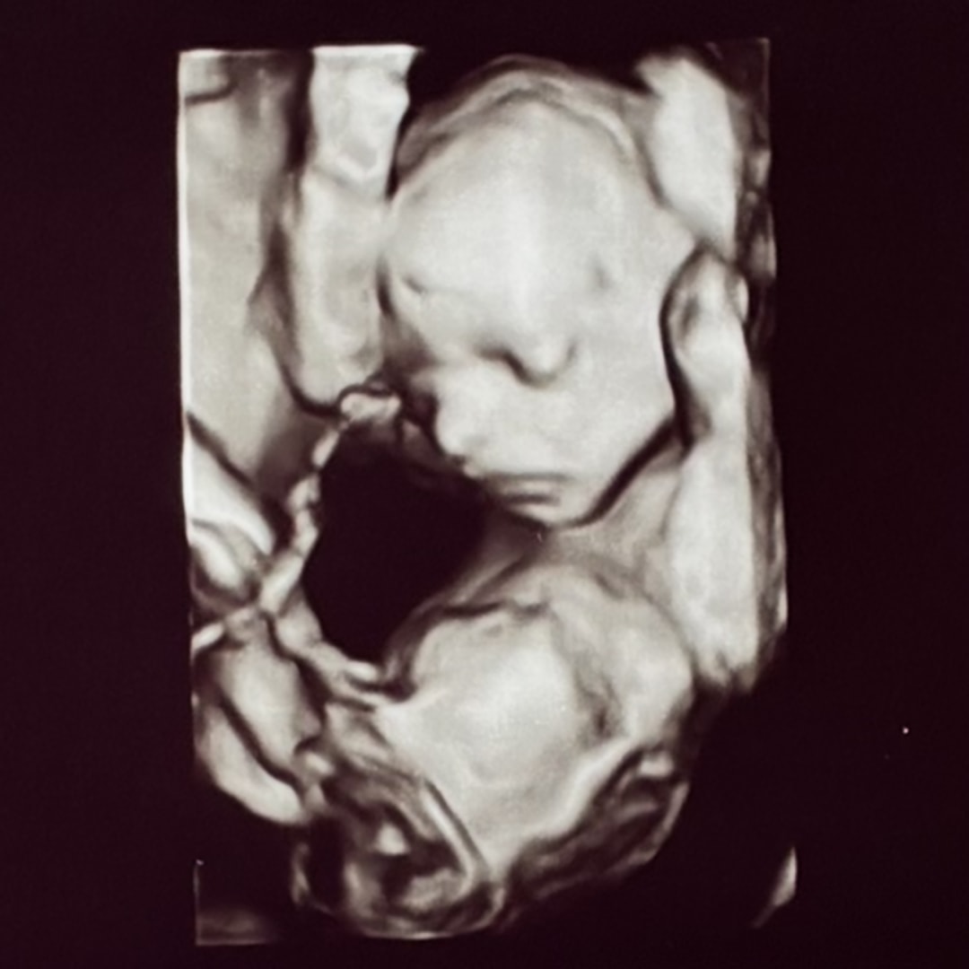 Photo shared by Helen for their Babylist baby registry.