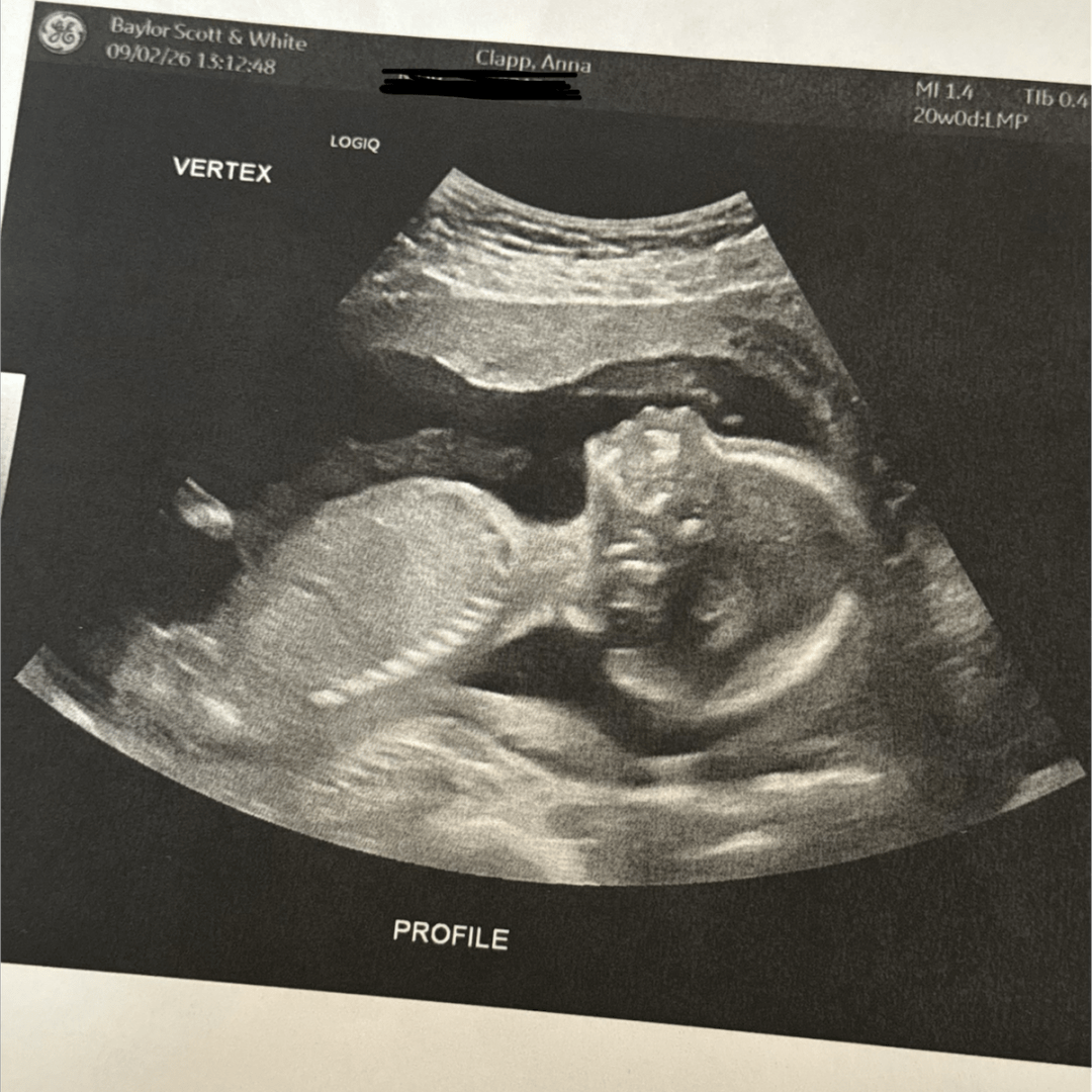 Photo shared by Anna for their Babylist baby registry.