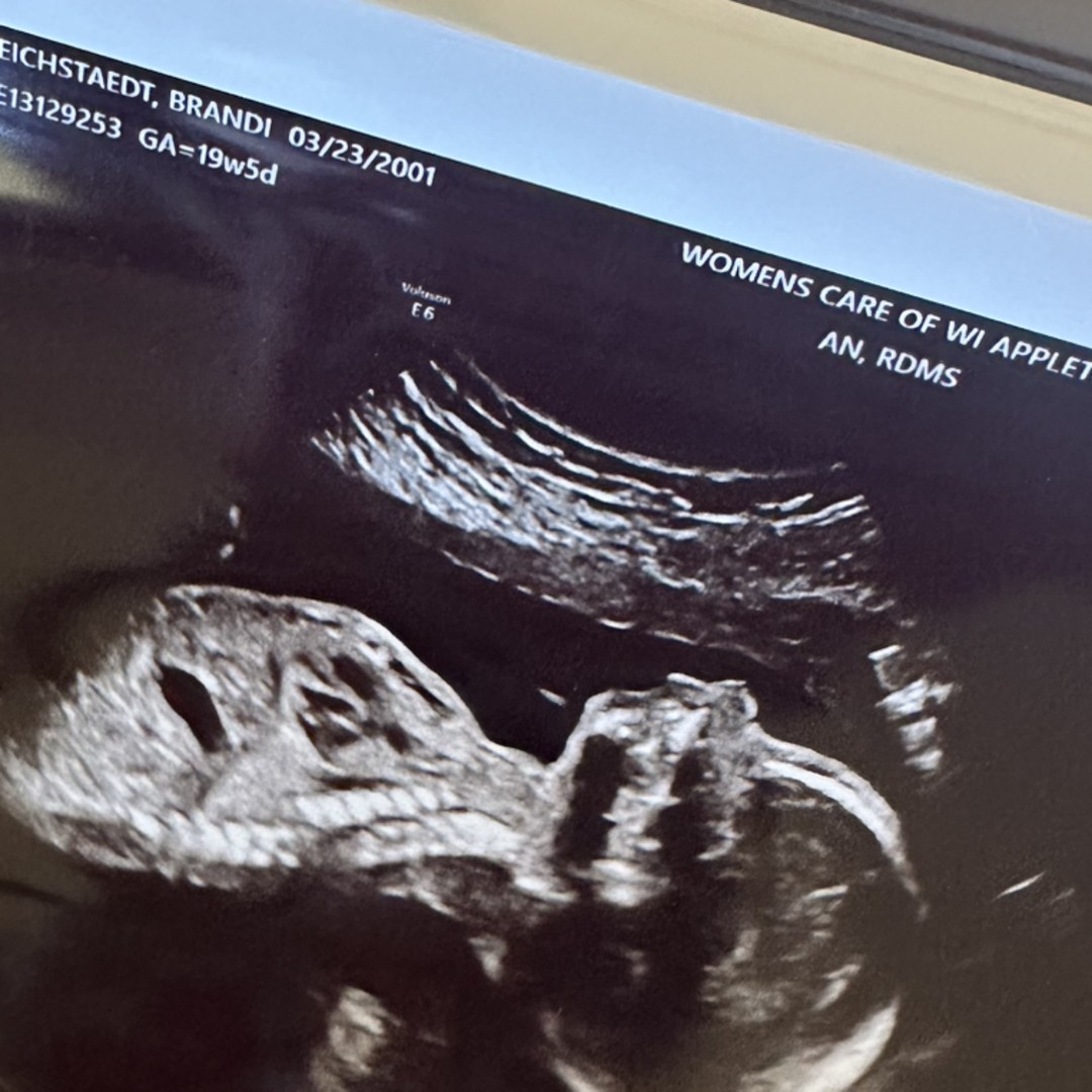 Photo shared by Brandi for their Babylist baby registry.