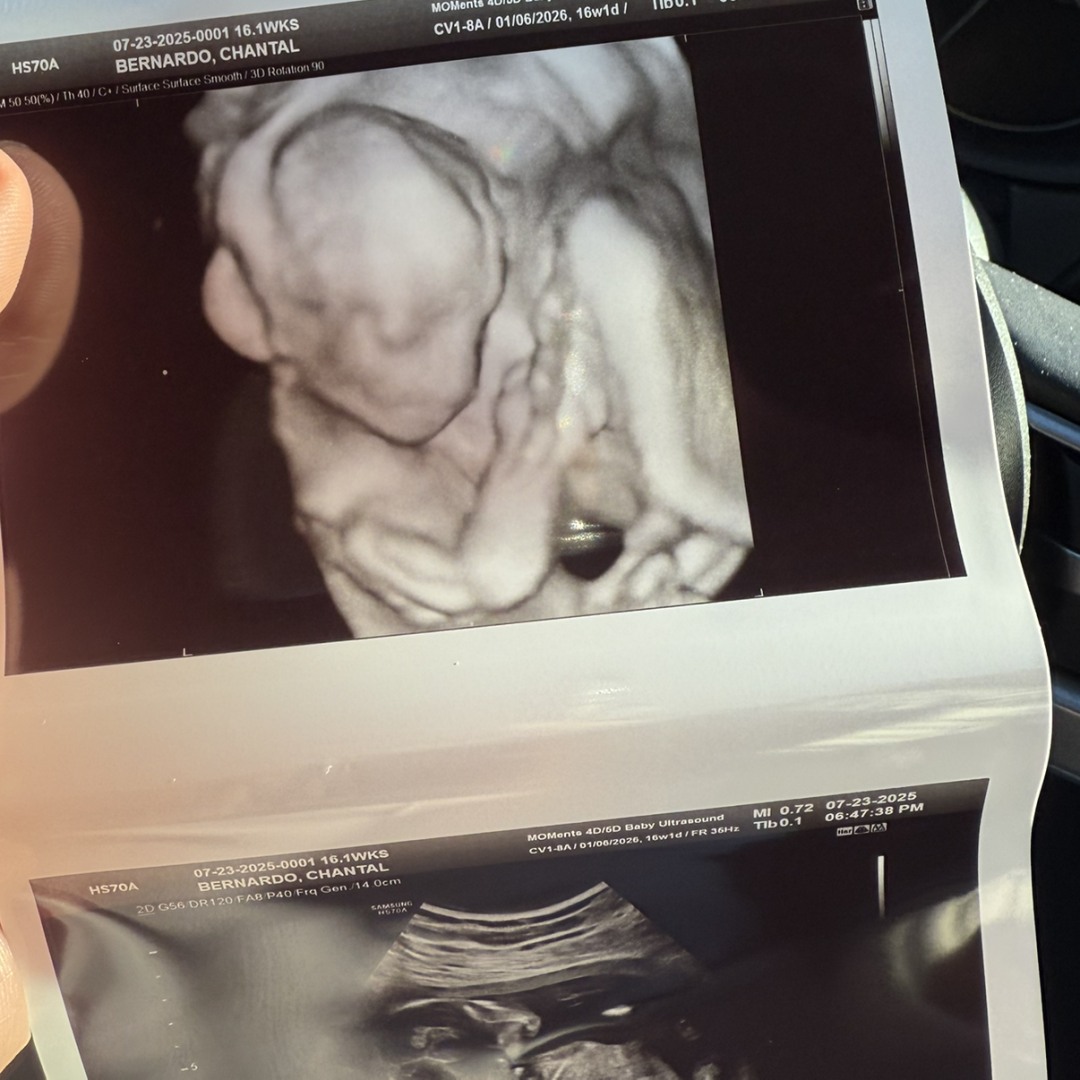 Photo shared by Chantal for their Babylist baby registry.