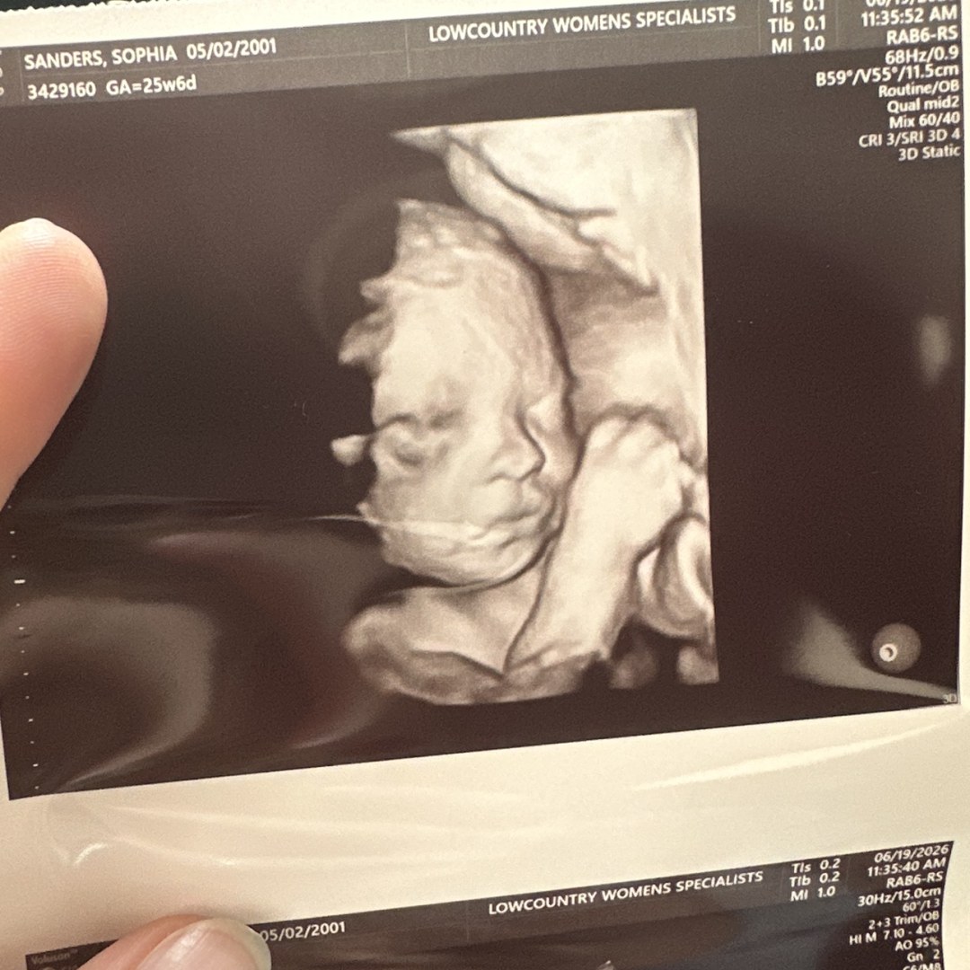 Photo shared by Sophie for their Babylist baby registry.