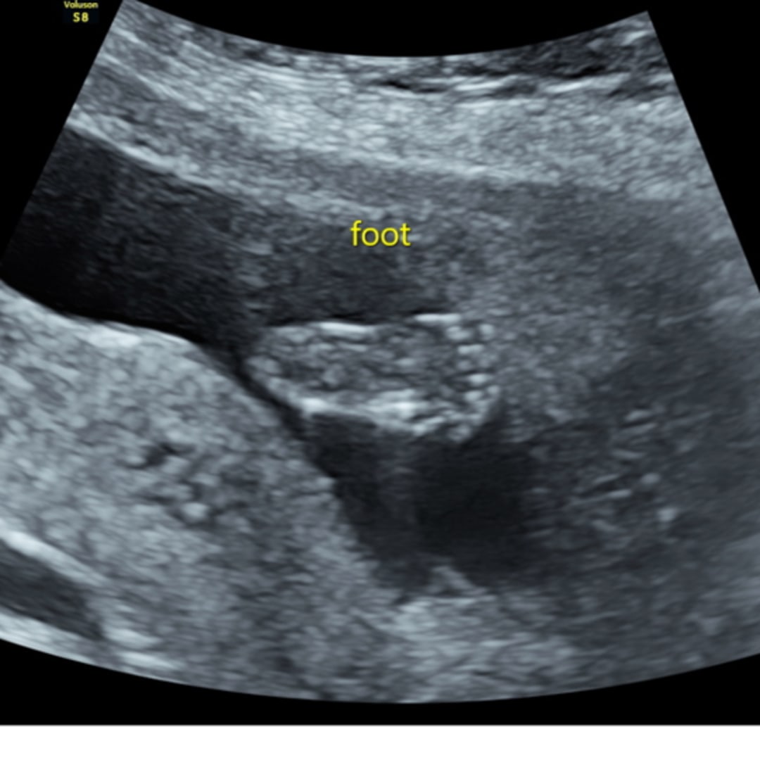 Photo shared by Destiny for their Babylist baby registry.
