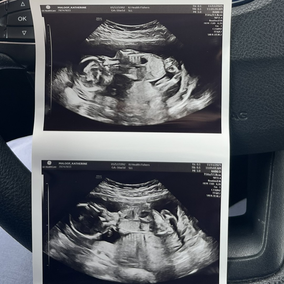 Photo shared by Kath for their Babylist baby registry.